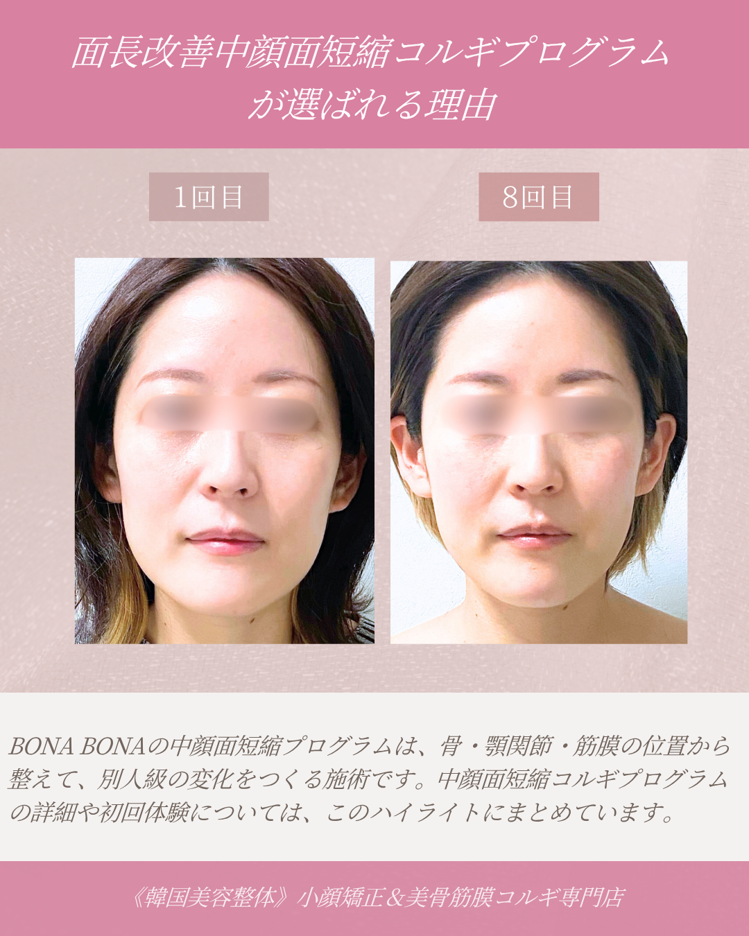 面長改善中顔面短縮コルギプログラムが選ばれる理由